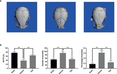 Tussilagone Inhibits Osteoclastogenesis and Periprosthetic Osteolysis by Suppressing the NF-κB and P38 MAPK Signaling Pathways